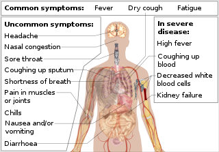 Symptômes et préventions coronavirus